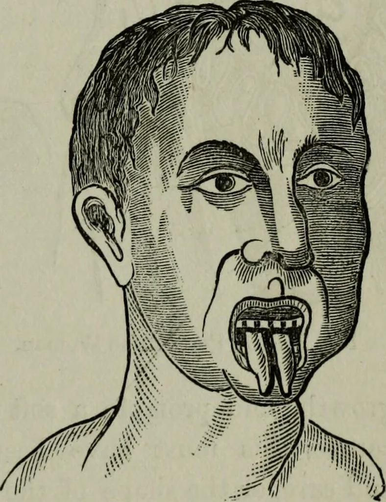 An illustration from Nature's revelations of character, or, Physiognomy illustrated : a description of the mental, moral and volitive dispositions of mankind, as manifested in the human form and countenance, 1887, leaf 546