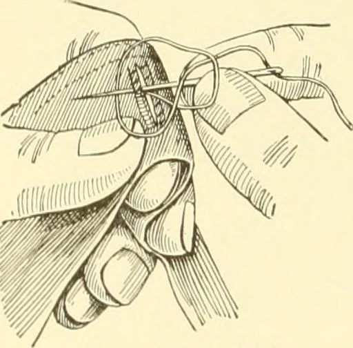 An illustration from The new dressmaker; with complete and fully illustrated instructions on every point connected with sewing, dressmaking and tailoring, from the actual stitches to the cutting, making, altering, mending, and cleaning of clothes for ladies, misses, girls, children, infants, men and boys, 1921, leaf 115