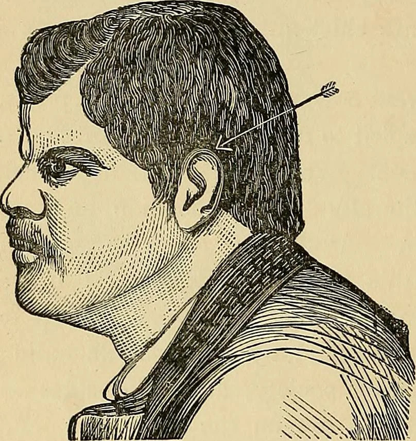 An illustration from A new illustrated hand-book of phrenology, physiology and physiognomy, 1878, leaf 177