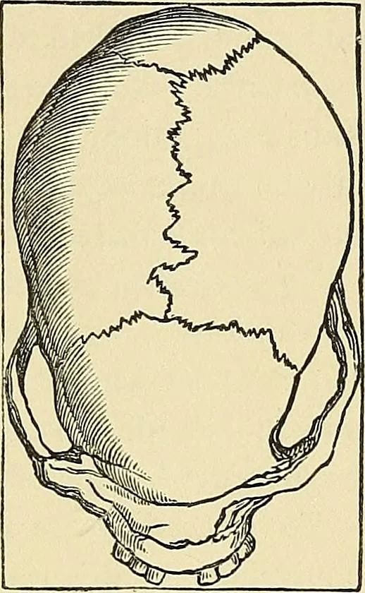 An illustration from A new illustrated hand-book of phrenology, physiology and physiognomy, 1878, leaf 192