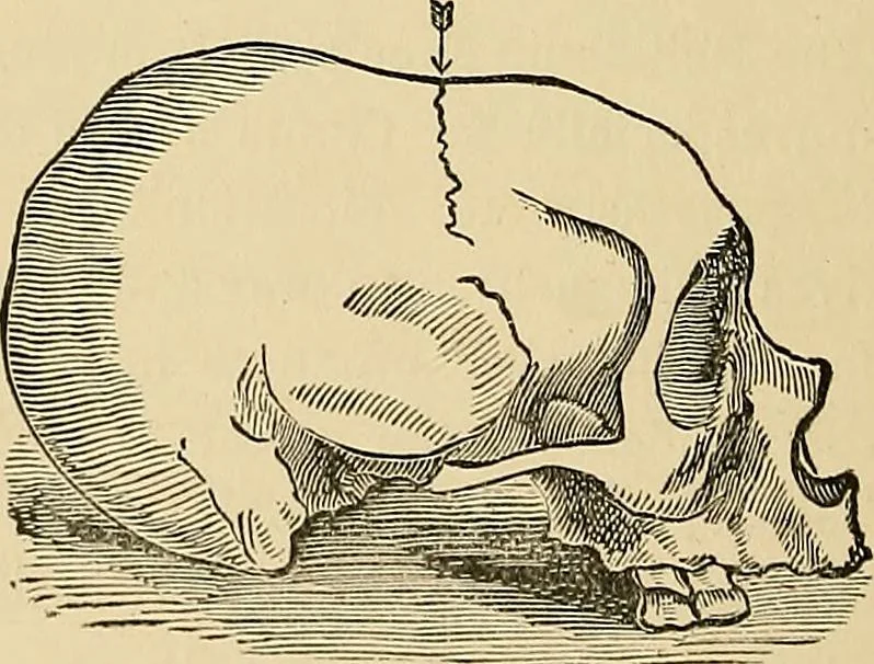 An illustration from A new illustrated hand-book of phrenology, physiology and physiognomy, 1878, leaf 221