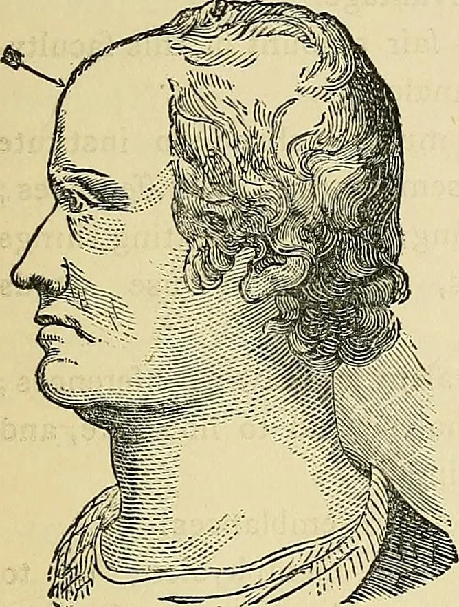 An illustration from A new illustrated hand-book of phrenology, physiology and physiognomy, 1878, leaf 288
