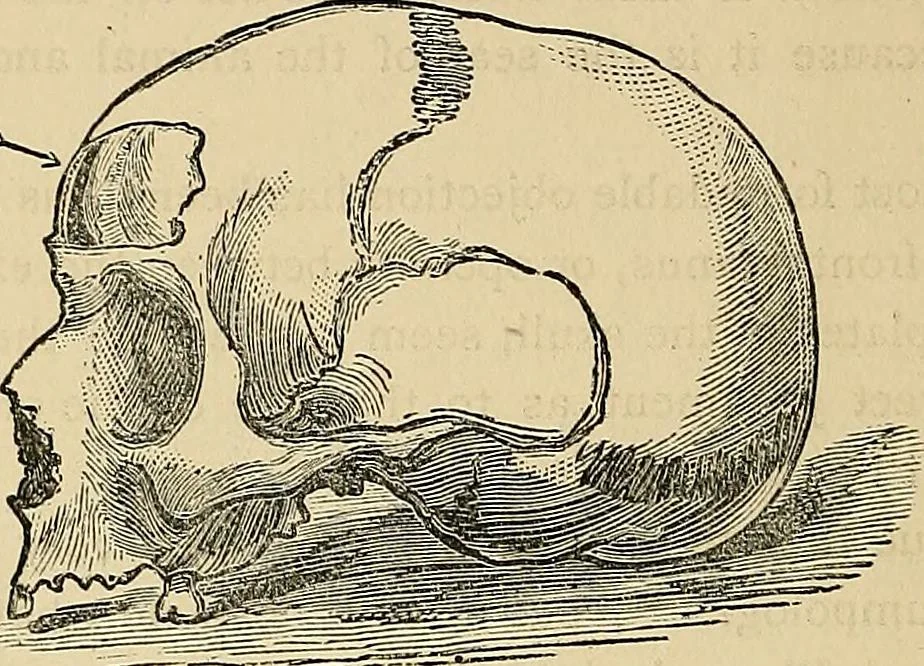 An illustration from A new illustrated hand-book of phrenology, physiology and physiognomy, 1878, leaf 295