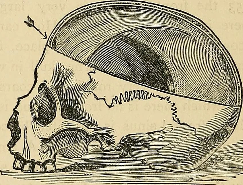 An illustration from A new illustrated hand-book of phrenology, physiology and physiognomy, 1878, leaf 295