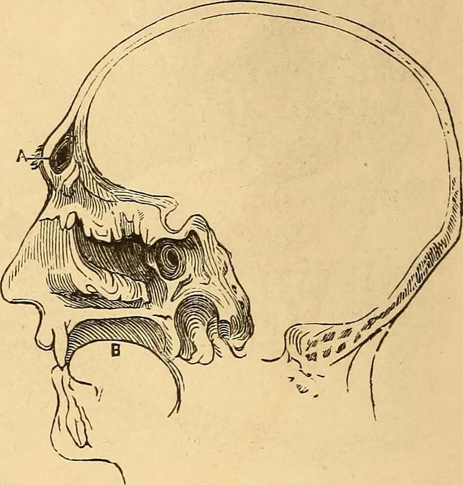 An illustration from New physiognomy, 1867, leaf 151