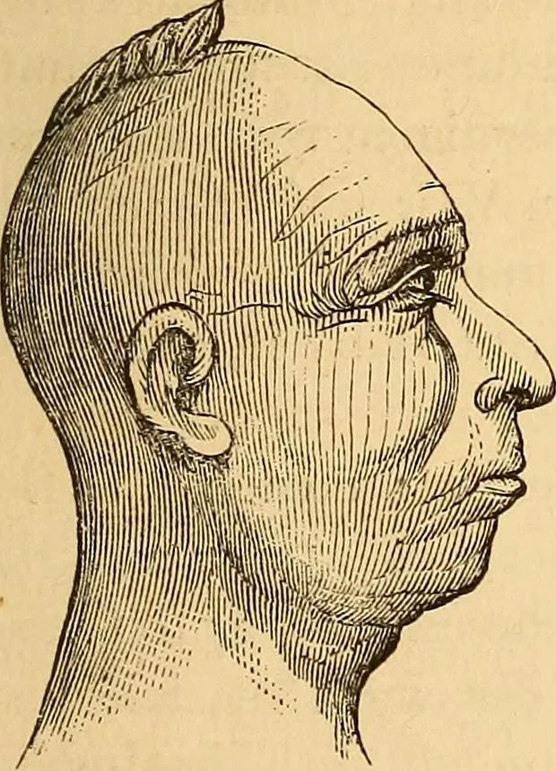 An illustration from New physiognomy, 1867, leaf 160