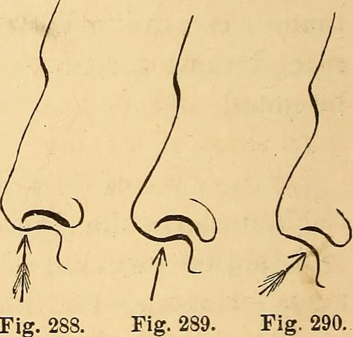 An illustration from New physiognomy, 1867, leaf 215