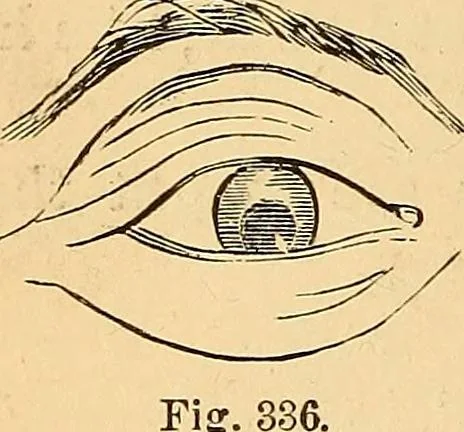 An illustration from New physiognomy, 1867, leaf 239