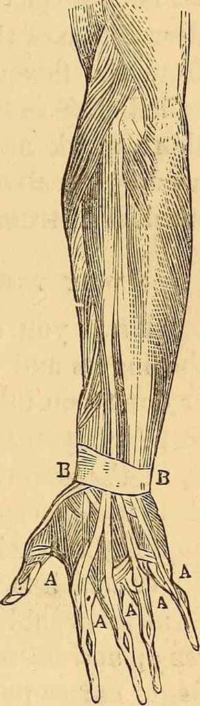 An illustration from New physiognomy, 1867, leaf 304