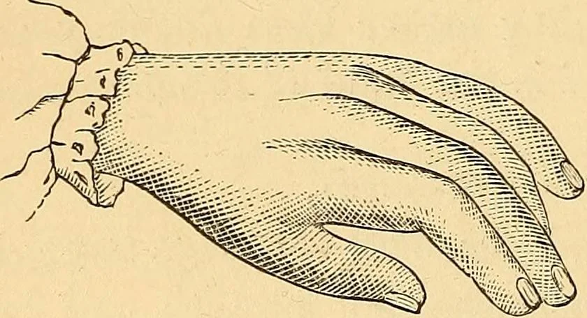 An illustration from New physiognomy, 1867, leaf 311