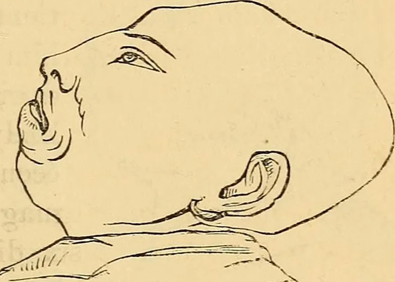 An illustration from New physiognomy, 1867, leaf 362