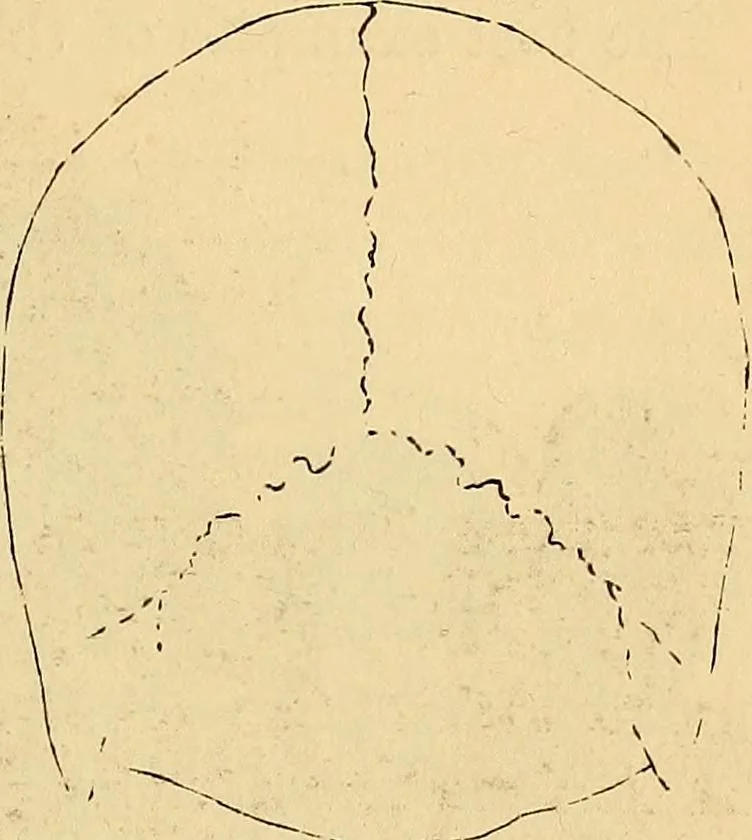 An illustration from New physiognomy, 1867, leaf 396