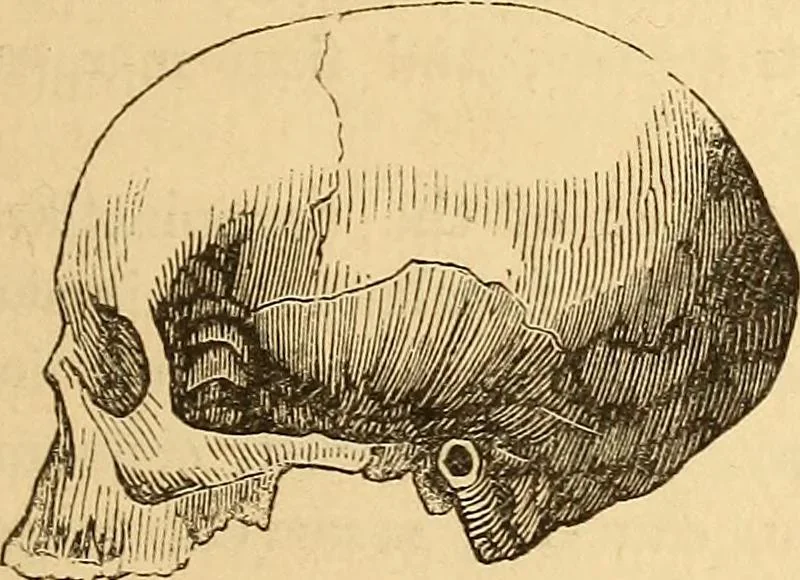 An illustration from New physiognomy, 1867, leaf 420