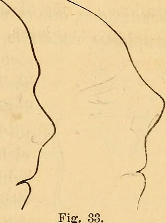 An illustration from New physiognomy, 1867, leaf 44