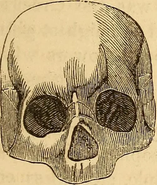 An illustration from New physiognomy, 1867, leaf 444