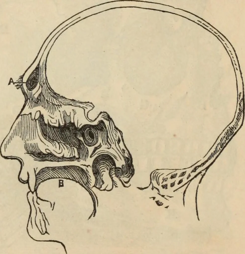 An illustration from New Physiognomy : or signs of character, as manifested through temperament and external forms, and especially in the "the human face divine.", 1889, leaf 151