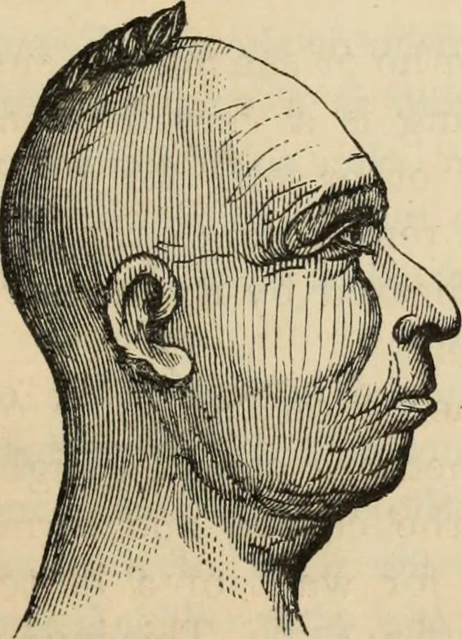 An illustration from New Physiognomy : or signs of character, as manifested through temperament and external forms, and especially in the "the human face divine.", 1889, leaf 160