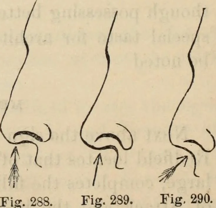 An illustration from New Physiognomy : or signs of character, as manifested through temperament and external forms, and especially in the "the human face divine.", 1889, leaf 215