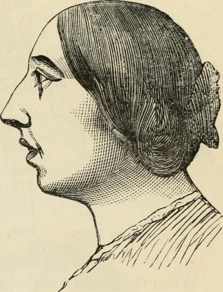An illustration from New Physiognomy : or signs of character, as manifested through temperament and external forms, and especially in the "the human face divine.", 1889, leaf 266