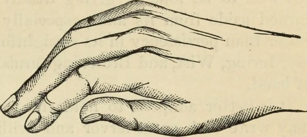 An illustration from New Physiognomy : or signs of character, as manifested through temperament and external forms, and especially in the "the human face divine.", 1889, leaf 310