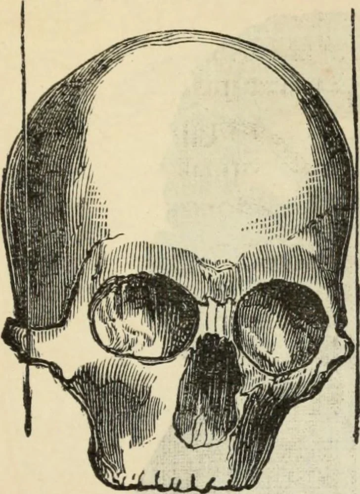 An illustration from New Physiognomy : or signs of character, as manifested through temperament and external forms, and especially in the "the human face divine.", 1889, leaf 390