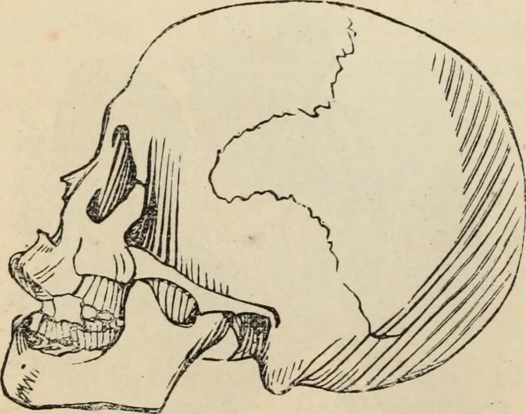 An illustration from New Physiognomy : or signs of character, as manifested through temperament and external forms, and especially in the "the human face divine.", 1889, leaf 391
