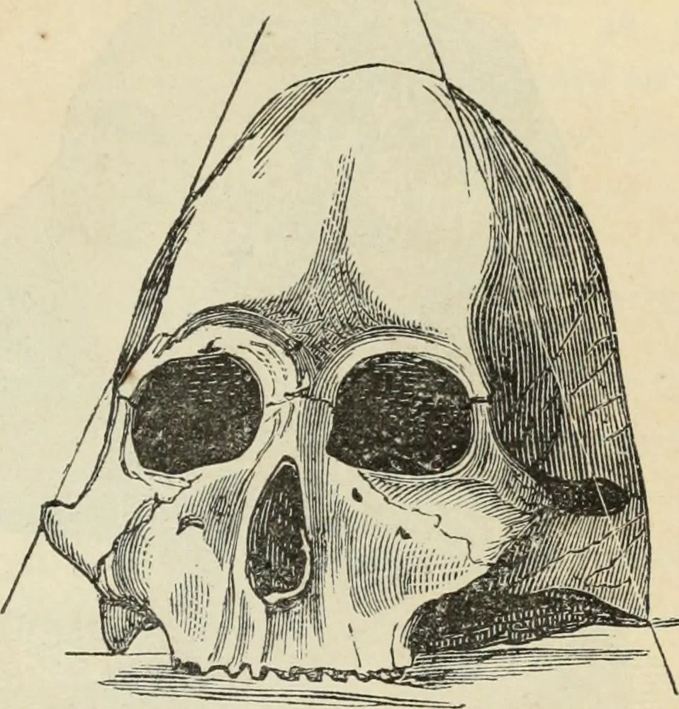 An illustration from New Physiognomy : or signs of character, as manifested through temperament and external forms, and especially in the "the human face divine.", 1889, leaf 392