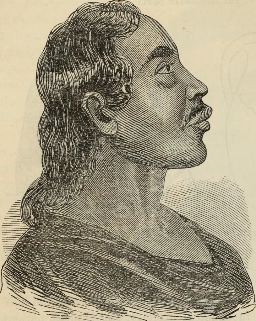 An illustration from New Physiognomy : or signs of character, as manifested through temperament and external forms, and especially in the "the human face divine.", 1889, leaf 393