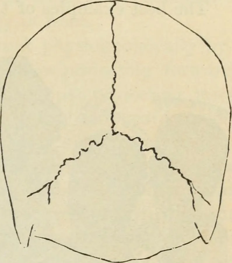 An illustration from New Physiognomy : or signs of character, as manifested through temperament and external forms, and especially in the "the human face divine.", 1889, leaf 396