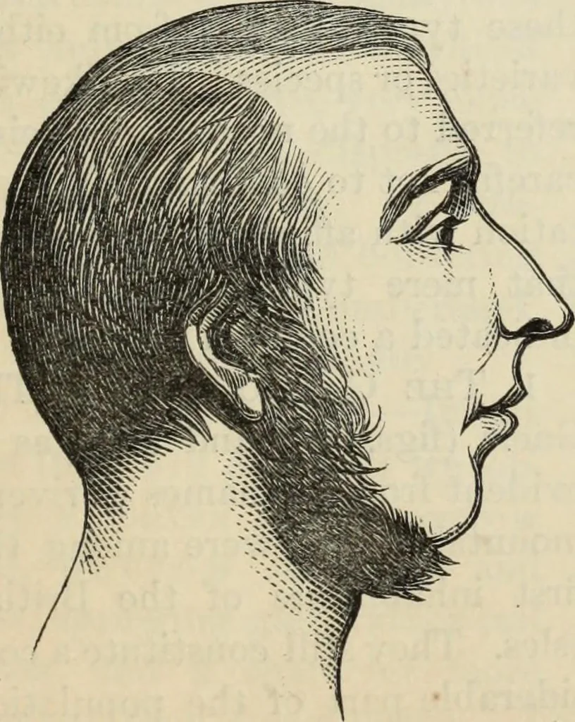 An illustration from New Physiognomy : or signs of character, as manifested through temperament and external forms, and especially in the "the human face divine.", 1889, leaf 410