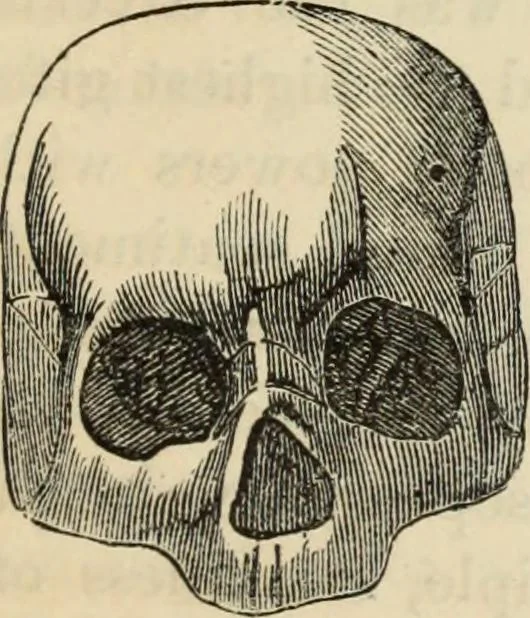 An illustration from New Physiognomy : or signs of character, as manifested through temperament and external forms, and especially in the "the human face divine.", 1889, leaf 444