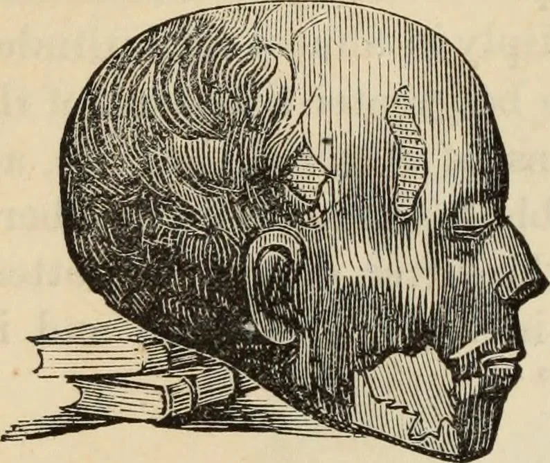 An illustration from New Physiognomy : or signs of character, as manifested through temperament and external forms, and especially in the "the human face divine.", 1889, leaf 455