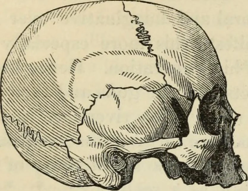 An illustration from New Physiognomy : or signs of character, as manifested through temperament and external forms, and especially in the "the human face divine.", 1889, leaf 456