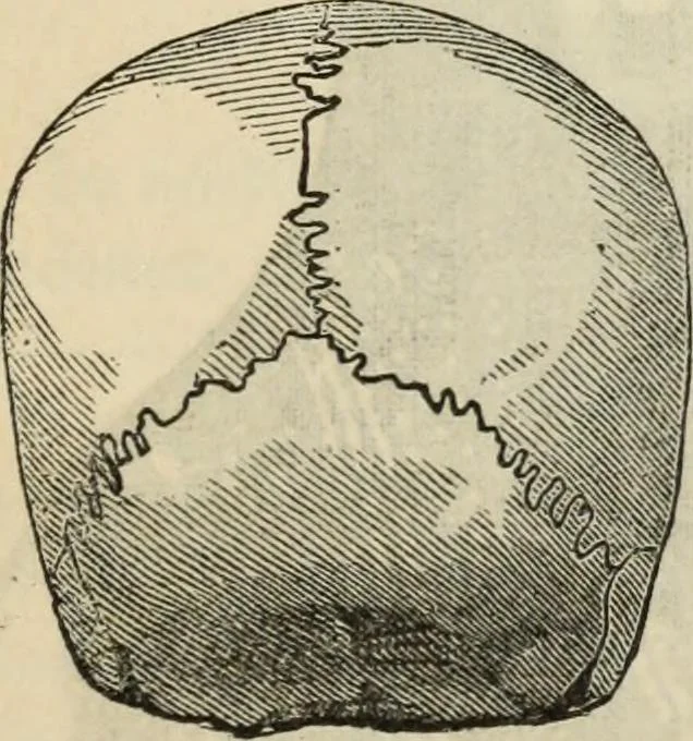 An illustration from New Physiognomy : or signs of character, as manifested through temperament and external forms, and especially in the "the human face divine.", 1889, leaf 456