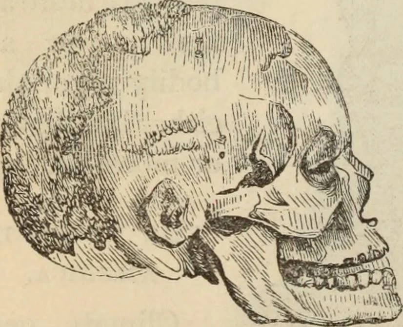 An illustration from New Physiognomy : or signs of character, as manifested through temperament and external forms, and especially in the "the human face divine.", 1889, leaf 471