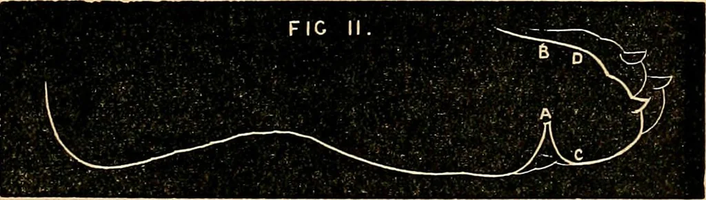 An illustration from Nineteenth century miracles; or spirits and their work in every country of the earth. A complete historical compendium of the great movement known as "modern spiritualism.", 1883, leaf 244