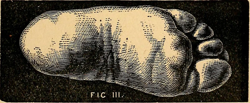 An illustration from Nineteenth century miracles; or spirits and their work in every country of the earth. A complete historical compendium of the great movement known as "modern spiritualism.", 1883, leaf 244
