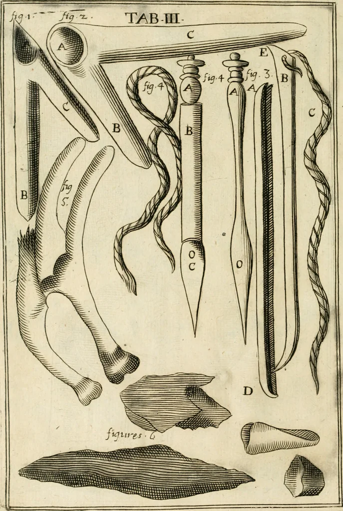 An illustration from Observations chirvrgiqves, 1669, leaf 29