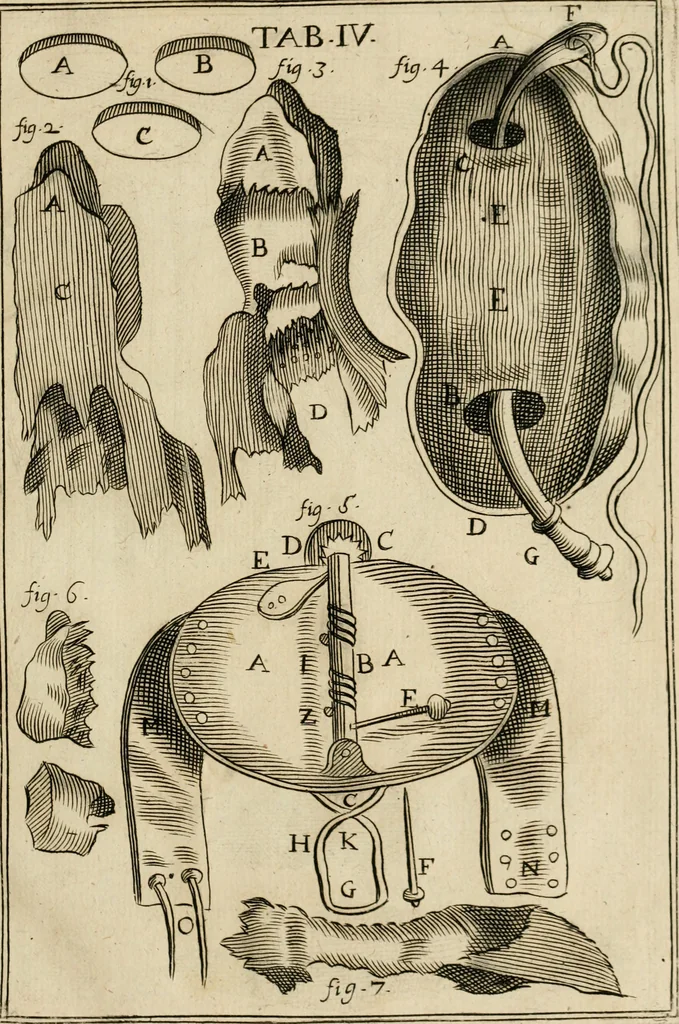 An illustration from Observations chirvrgiqves, 1669, leaf 30