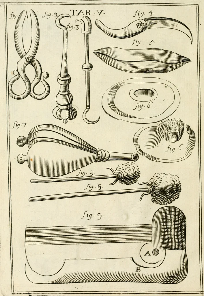 An illustration from Observations chirvrgiqves, 1669, leaf 33
