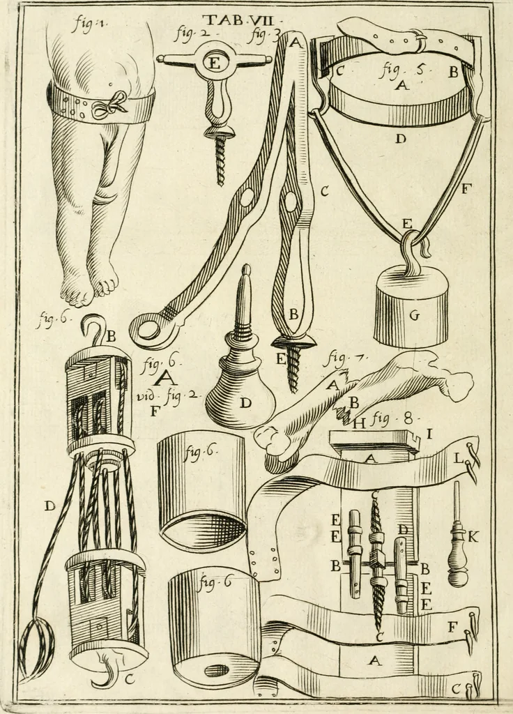 An illustration from Observations chirvrgiqves, 1669, leaf 37