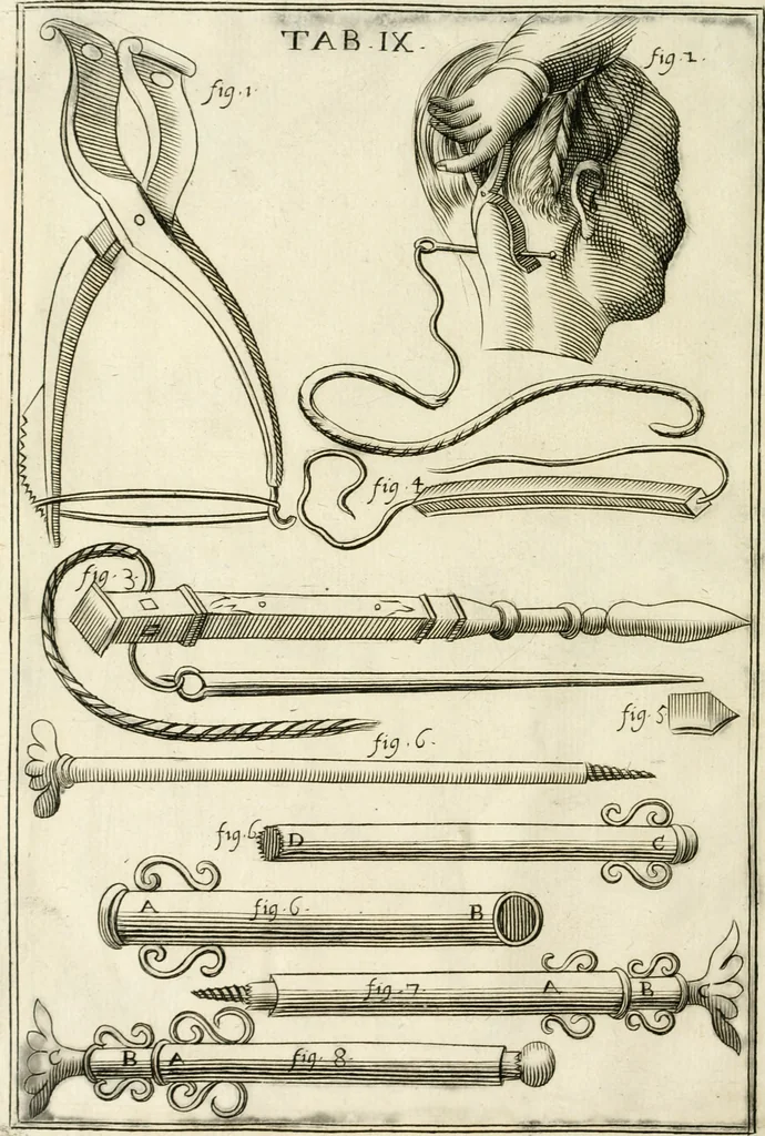 An illustration from Observations chirvrgiqves, 1669, leaf 41