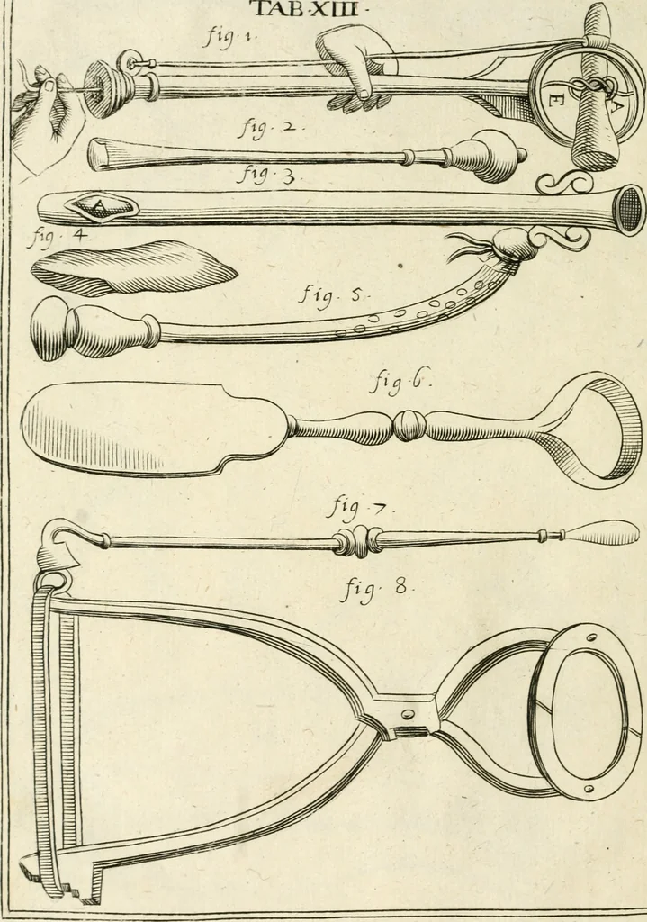An illustration from Observations chirvrgiqves, 1669, leaf 49