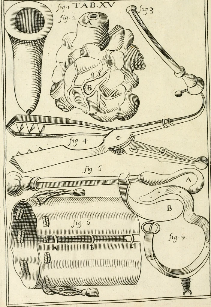 An illustration from Observations chirvrgiqves, 1669, leaf 53