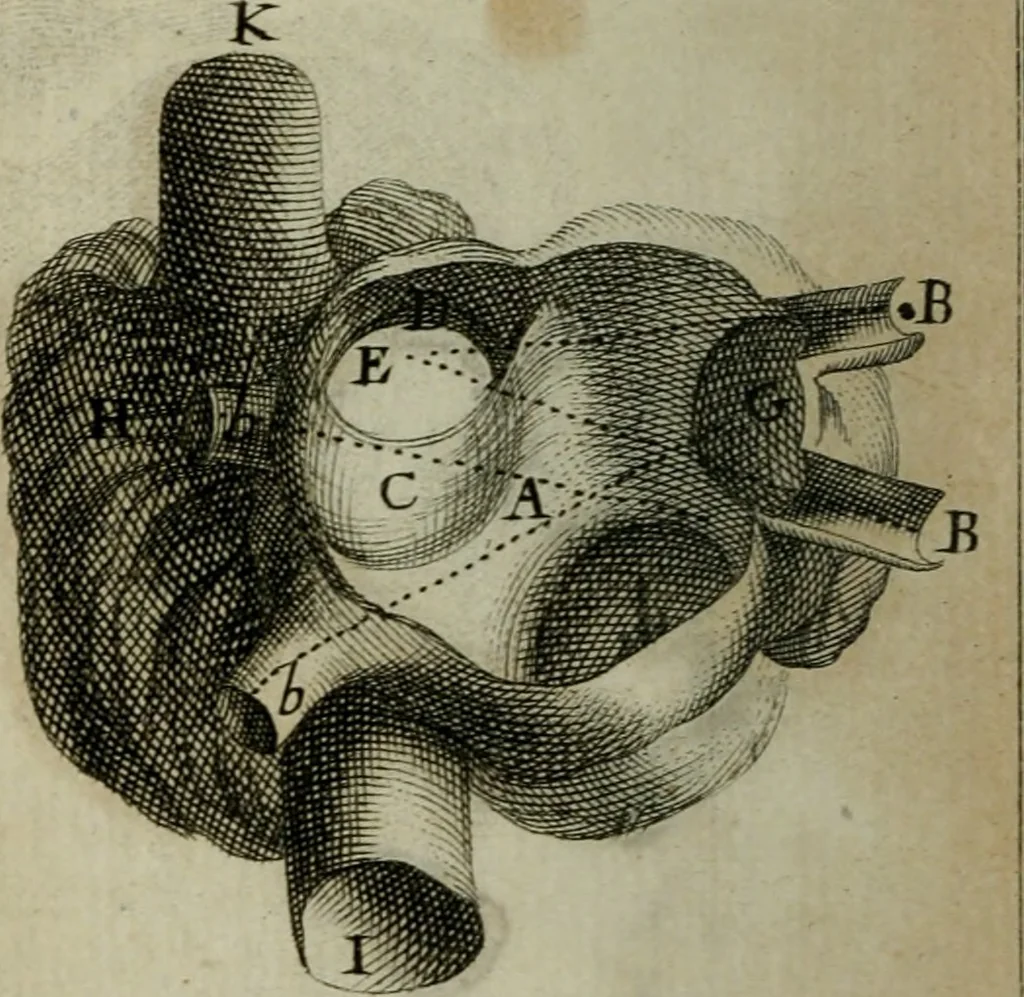 An illustration from Observations sur la maniere de tailler dans les deux sexes pour l'extraction de la pierre, pratiquée par Frere Jacques, 1700, leaf 155
