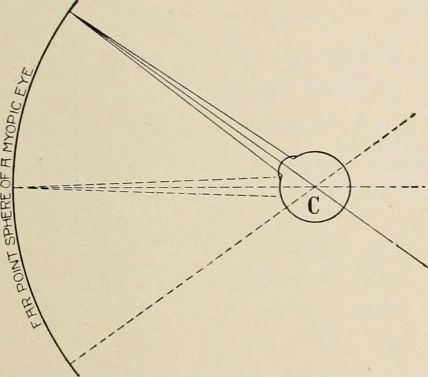An illustration from Ophthalmic lenses and accessories; lenses, frames, magnifiers and readers .., 1916, leaf 48