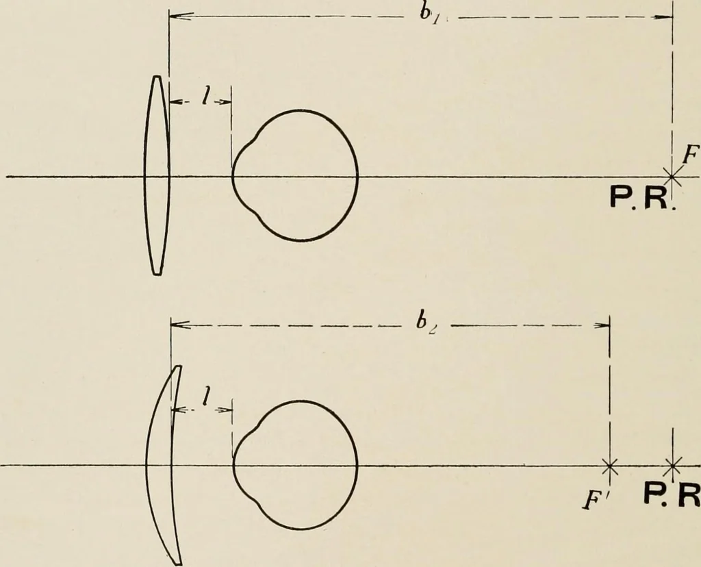 An illustration from Ophthalmic lenses and accessories; lenses, frames, magnifiers and readers .., 1916, leaf 49