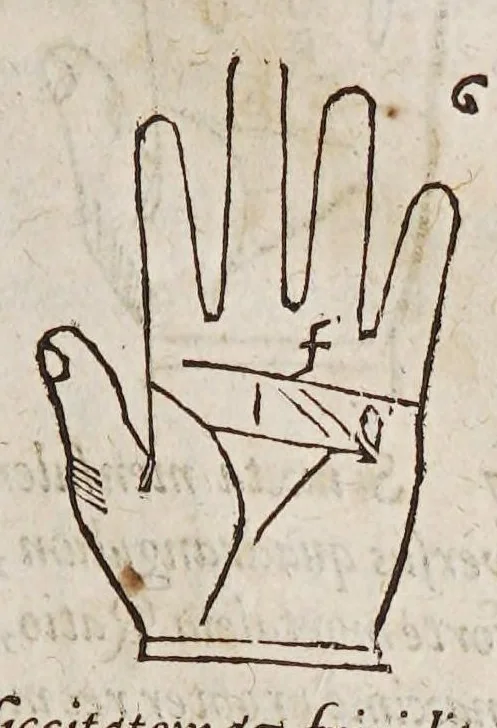 An illustration from Opus mathematicum octo libros complectens, : innumeris propemodum figuris idealibus manuum et physiognomiae, aliisque adornatum, quorum sex priores libri absolutissimae cheiromantiae theoricam, praxim, doctrinam, artem, & experientiam verissimam continent. Septimus physiognomiae dispositionem, hominʹumque omnium qualitates & complexiones. Octauus periaxiomata de faciebus signorum, & quid sol in vnaquaque domo existens, natis polliceatur. Remedia quoque omnium ægritudinum complectitur. Et naturalem astrologiam atq[ue] effectus lunae quoad diuersas ægritudines. Item isagogen astrologiæ iudiciariae, & totius diuinatricis artis encomia. Omnibus matheseos, cheiromantiae, philosophiae, & medicinæ studiosis vtiles ac necessarij., 1583, leaf 141