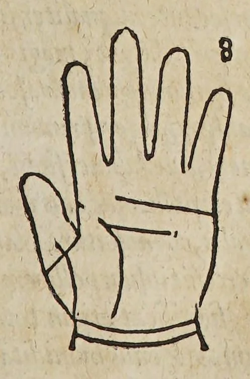 An illustration from Opus mathematicum octo libros complectens, : innumeris propemodum figuris idealibus manuum et physiognomiae, aliisque adornatum, quorum sex priores libri absolutissimae cheiromantiae theoricam, praxim, doctrinam, artem, & experientiam verissimam continent. Septimus physiognomiae dispositionem, hominʹumque omnium qualitates & complexiones. Octauus periaxiomata de faciebus signorum, & quid sol in vnaquaque domo existens, natis polliceatur. Remedia quoque omnium ægritudinum complectitur. Et naturalem astrologiam atq[ue] effectus lunae quoad diuersas ægritudines. Item isagogen astrologiæ iudiciariae, & totius diuinatricis artis encomia. Omnibus matheseos, cheiromantiae, philosophiae, & medicinæ studiosis vtiles ac necessarij., 1583, leaf 149