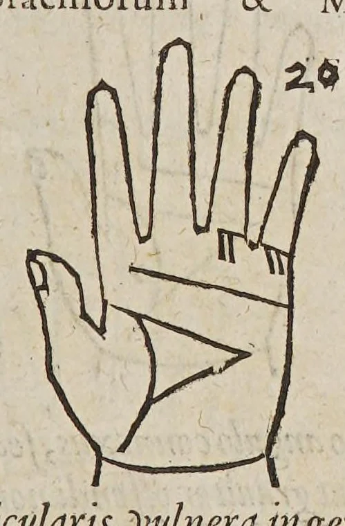 An illustration from Opus mathematicum octo libros complectens, : innumeris propemodum figuris idealibus manuum et physiognomiae, aliisque adornatum, quorum sex priores libri absolutissimae cheiromantiae theoricam, praxim, doctrinam, artem, & experientiam verissimam continent. Septimus physiognomiae dispositionem, hominʹumque omnium qualitates & complexiones. Octauus periaxiomata de faciebus signorum, & quid sol in vnaquaque domo existens, natis polliceatur. Remedia quoque omnium ægritudinum complectitur. Et naturalem astrologiam atq[ue] effectus lunae quoad diuersas ægritudines. Item isagogen astrologiæ iudiciariae, & totius diuinatricis artis encomia. Omnibus matheseos, cheiromantiae, philosophiae, & medicinæ studiosis vtiles ac necessarij., 1583, leaf 307
